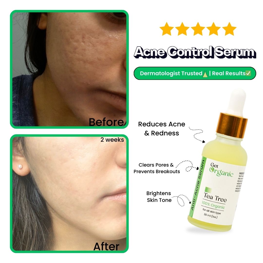 Anti-Acne Serum - GetOrganic
